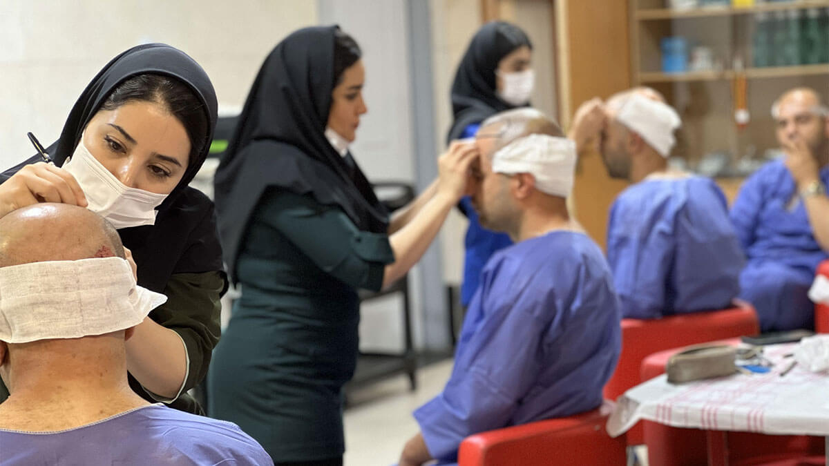 Hair Transplant for Gholami